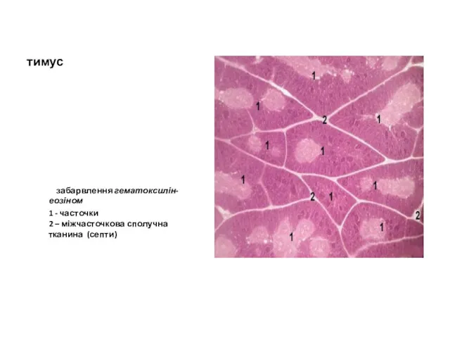 тимус забарвлення гематоксилін-еозіном 1 - часточки 2 – міжчасточкова сполучна тканина (септи)