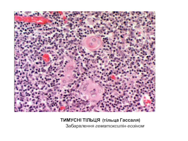 ТИМУСНІ ТІЛЬЦЯ (тільца Гассаля) Забарвлення гематоксилін-еозіном