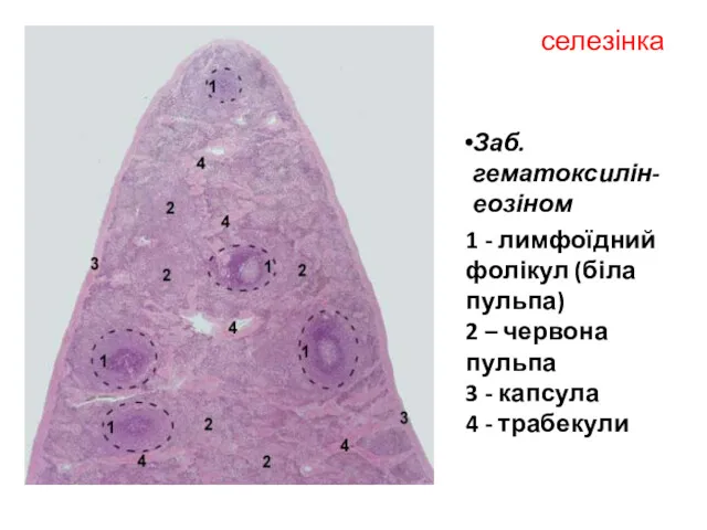 селезінка Заб. гематоксилін-еозіном 1 - лимфоїдний фолікул (біла пульпа) 2