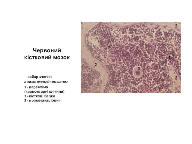 Червоний кістковий мозок забарвлення гематоксилін-еозином 1 - паренхіма (кровотворні клітини)