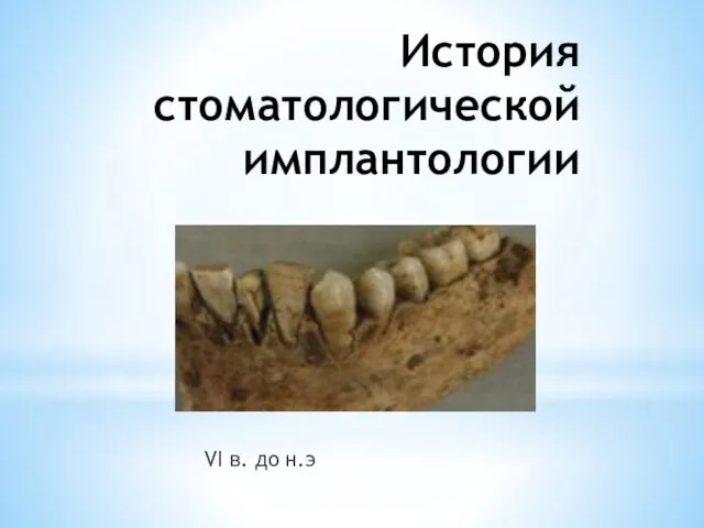 История стоматологической имплантологии VI в. до н.э