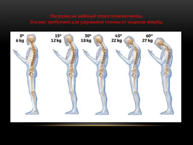 Нагрузка на шейный отдел позвоночника. Усилие, требуемое для удержания головы от падения вперёд.