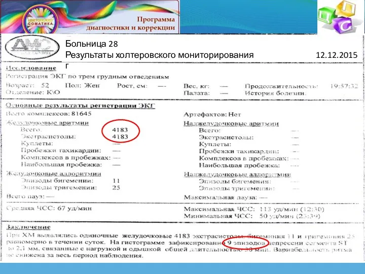 Больница 28 Результаты холтеровского мониторирования 12.12.2015г