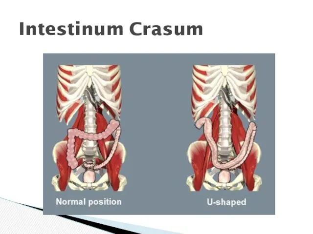 Intestinum Crasum