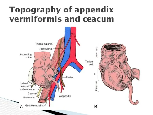 Topography of appendix vermiformis and ceacum