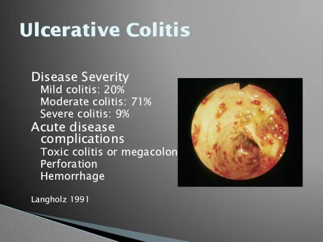 Ulcerative Colitis Disease Severity Mild colitis: 20% Moderate colitis: 71% Severe colitis: 9%