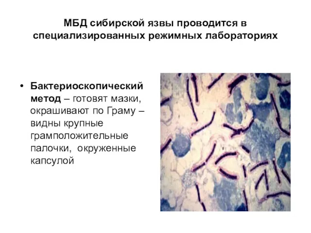 МБД сибирской язвы проводится в специализированных режимных лабораториях Бактериоскопический метод