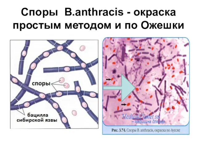 Споры B.anthracis - окраска простым методом и по Ожешки