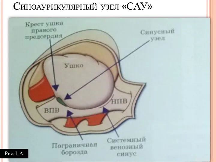 Рис.1 А Синоаурикулярный узел «САУ»