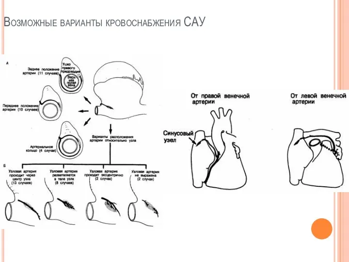 Возможные варианты кровоснабжения САУ