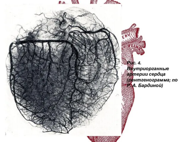 Рис. 4. Внутриорганные артерии сердца (рентгенограмма; по Р. А. Бардиной)
