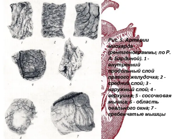Рис. 5. Артерии миокарда (рентгенограммы; по Р. А. Бардиной). 1