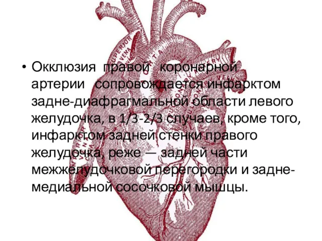 Окклюзия правой коронарной артерии сопровождается инфарктом задне-диафрагмальной области левого желудочка,