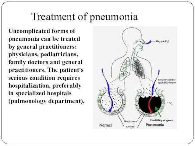 Treatment of pneumonia Uncomplicated forms of pneumonia can be treated