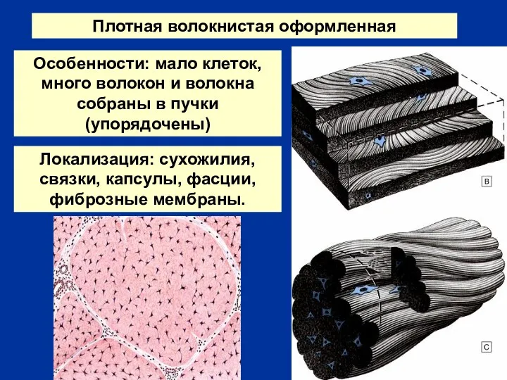 Плотная волокнистая оформленная Особенности: мало клеток, много волокон и волокна