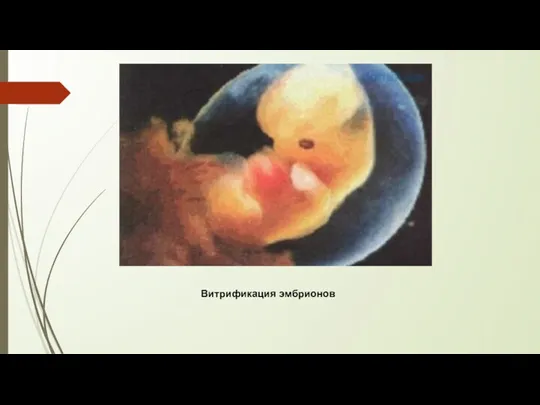 Витрификация эмбрионов