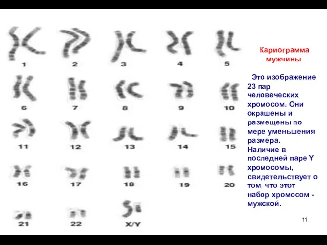 Кариограмма мужчины Это изображение 23 пар человеческих хромосом. Они окрашены и размещены по