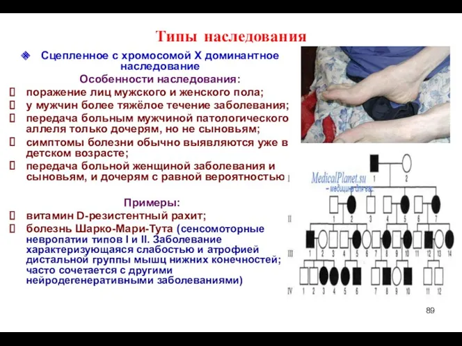 Типы наследования Сцепленное с хромосомой Х доминантное наследование Особенности наследования: поражение лиц мужского