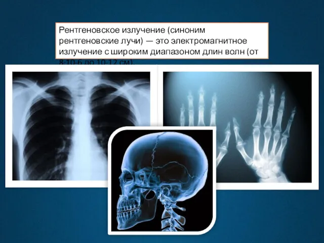 Рентгеновское излучение (синоним рентгеновские лучи) — это электромагнитное излучение с