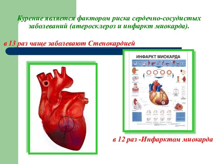 Курение является фактором риска сердечно-сосудистых заболеваний (атеросклероз и инфаркт миокарда).