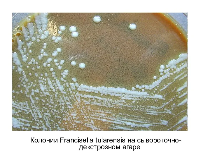 Колонии Francisella tularensis на сывороточно-декстрозном агаре