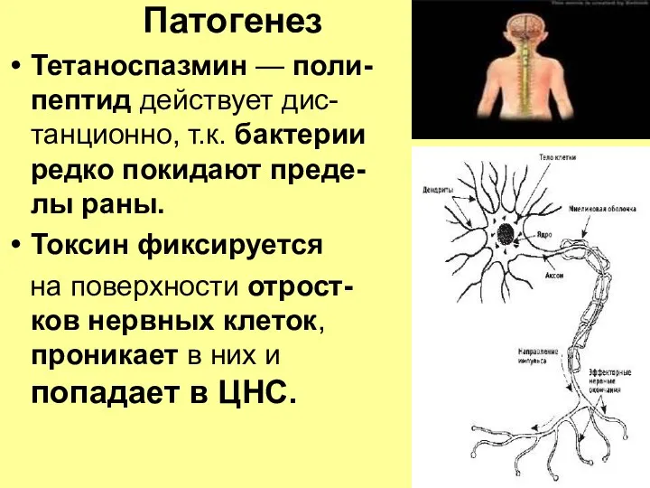 Патогенез Тетаноспазмин — поли-пептид действует дис-танционно, т.к. бактерии редко покидают