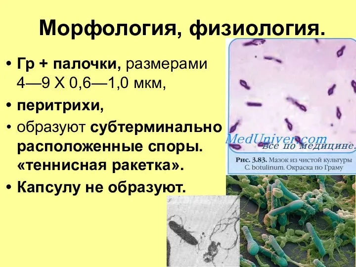 Морфология, физиология. Гр + палочки, размерами 4—9 X 0,6—1,0 мкм,