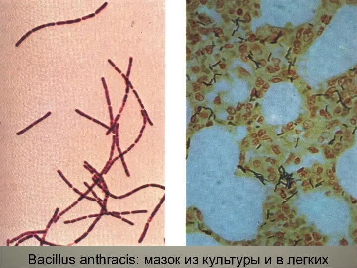 Bacillus anthracis: мазок из культуры и в легких