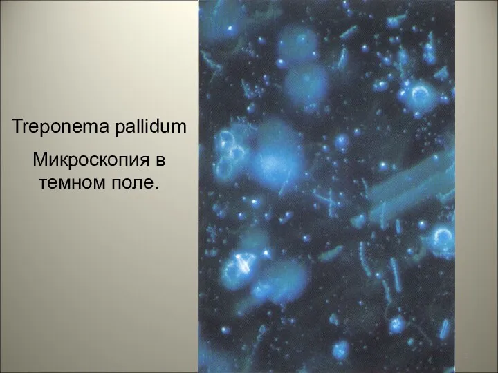 Treponema pallidum Микроскопия в темном поле.