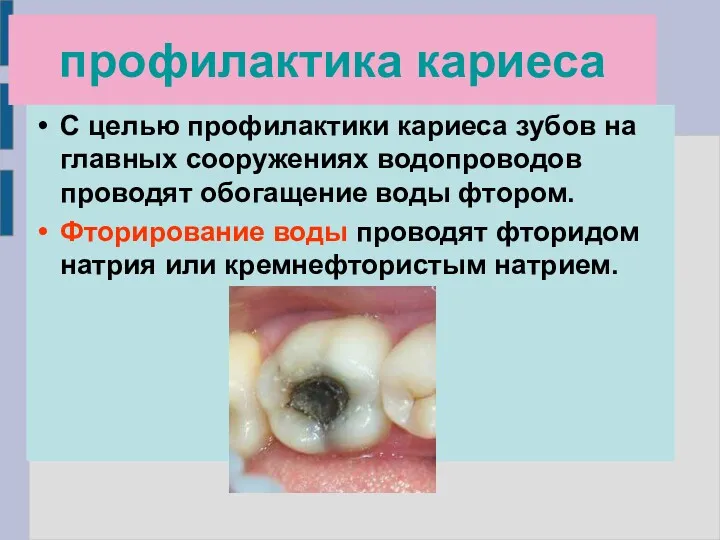 профилактика кариеса С целью профилактики кариеса зубов на главных сооружениях