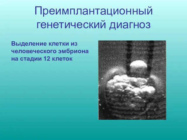 Преимплантационный генетический диагноз Выделение клетки из человеческого эмбриона на стадии 12 клеток