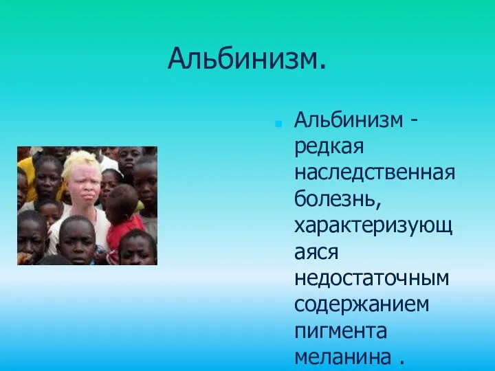 Альбинизм. Альбинизм - редкая наследственная болезнь, характеризующаяся недостаточным содержанием пигмента меланина . Альбинизм - на