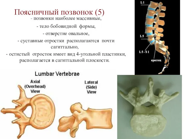 Поясничный позвонок (5) - позвонки наиболее массивные, - тело бобовидной