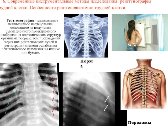 6. Современные инструментальные методы исследования: рентгенография грудной клетки. Особенности рентгеноанатомии