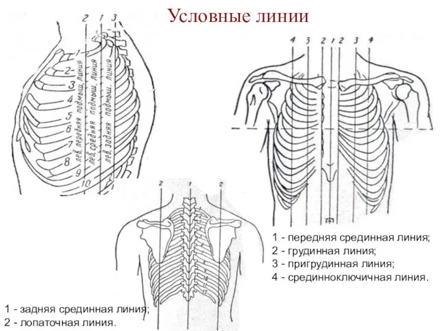 Условные линии 1 - передняя срединная линия; 2 - грудинная