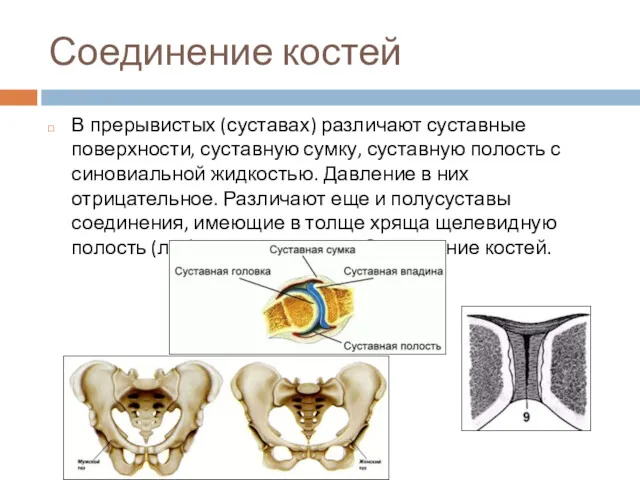 Соединение костей В прерывистых (суставах) различают суставные поверхности, суставную сумку,