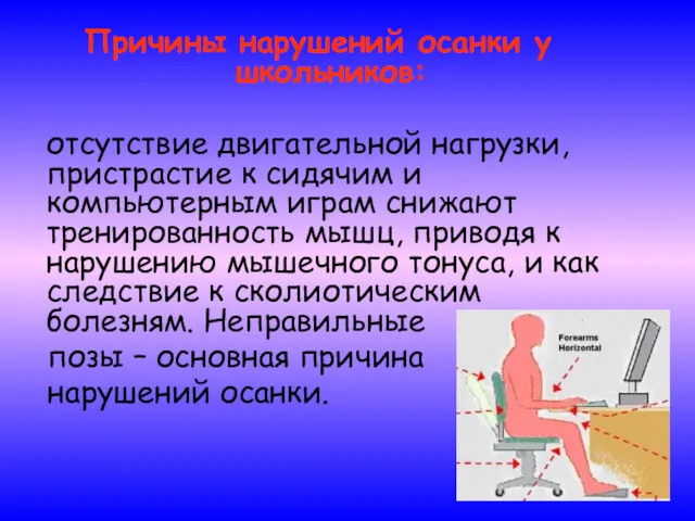 Причины нарушений осанки у школьников: отсутствие двигательной нагрузки, пристрастие к