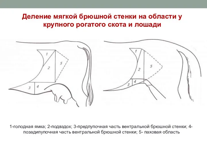 1-гoлoднaя ямкa; 2-пoдвздox; 3-предпупочная часть вентральной брюшной стенки; 4- позадипупочная