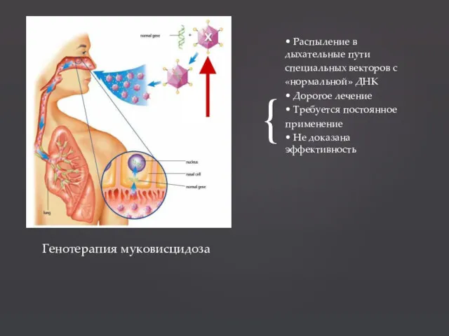 • Распыление в дыхательные пути специальных векторов с «нормальной» ДНК