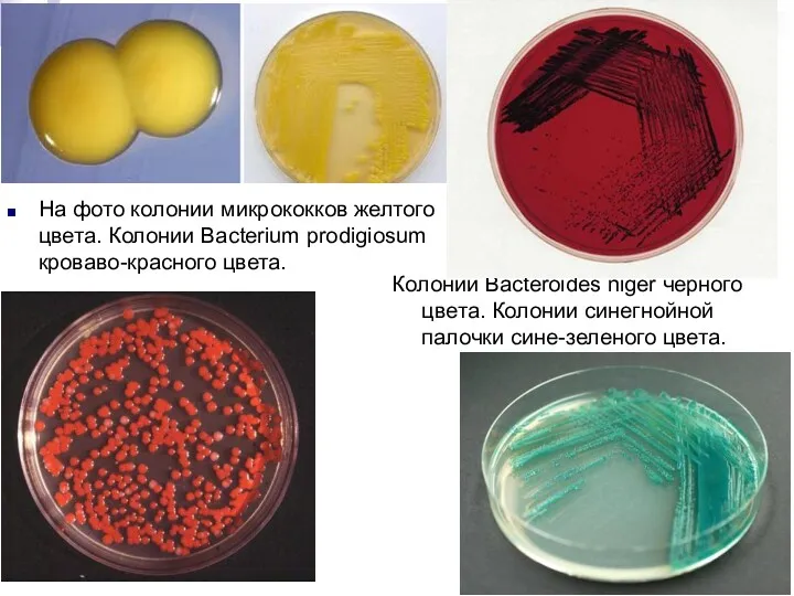 На фото колонии микрококков желтого цвета. Колонии Bacterium prodigiosum кроваво-красного