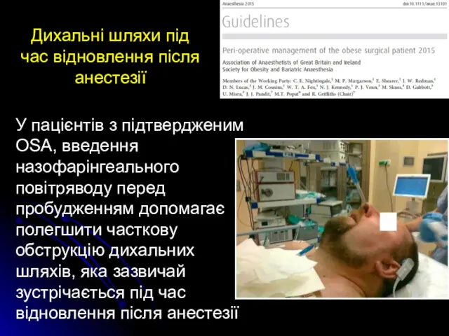 Дихальні шляхи під час відновлення після анестезії У пацієнтів з