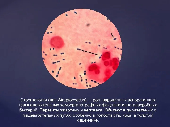 Стрептококки (лат. Streptococcus) — род шаровидных аспорогенных грамположительных хемоорганотрофных факультативно-анаэробных