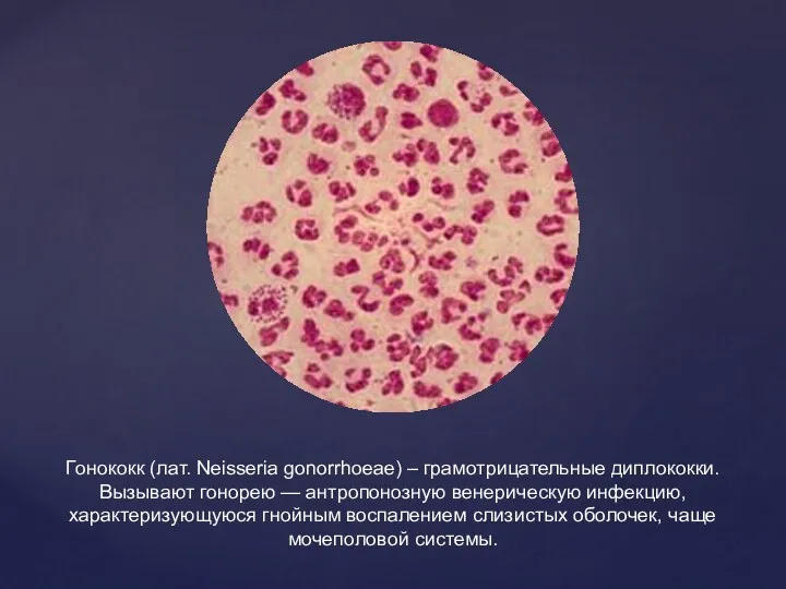 Гонококк (лат. Neisseria gonorrhoeae) – грамотрицательные диплококки. Вызывают гонорею —