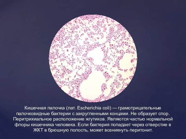 Кишечная палочка (лат. Escherichia coli) — грамотрицательные палочковидные бактерии с