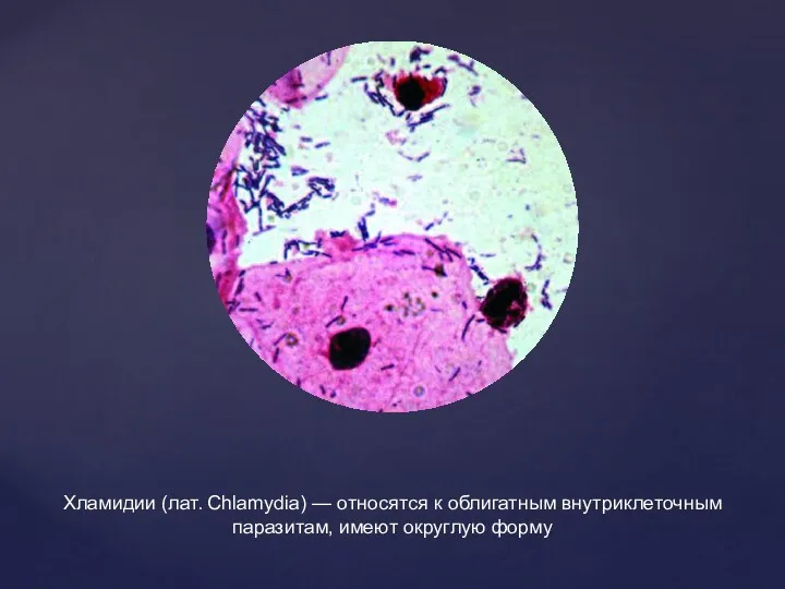Хламидии (лат. Chlamydia) — относятся к облигатным внутриклеточным паразитам, имеют округлую форму