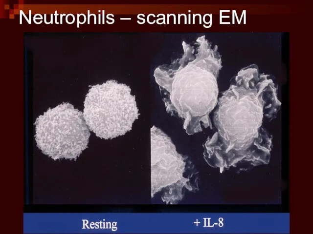 Neutrophils – scanning EM