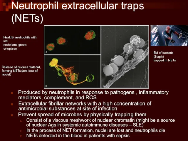 Neutrophil extracellular traps (NETs) Produced by neutrophils in response to