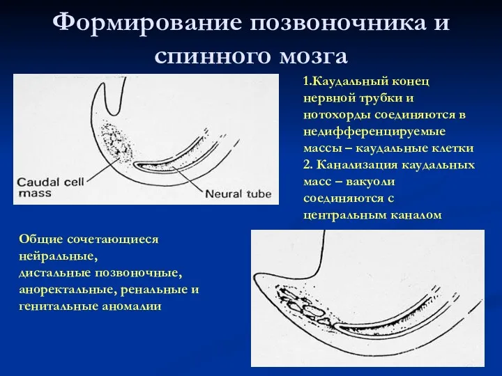 Формирование позвоночника и спинного мозга 1.Каудальный конец нервной трубки и нотохорды соединяются в