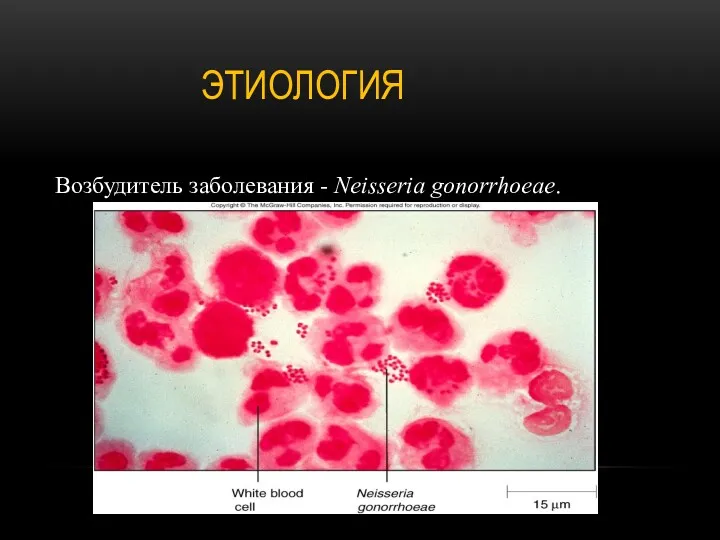 ЭТИОЛОГИЯ Возбудитель заболевания - Neisseria gonorrhoeae.