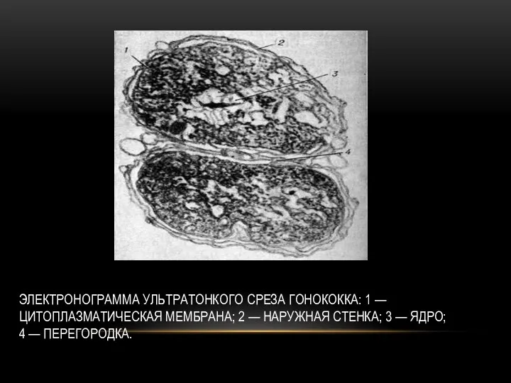 ЭЛЕКТРОНОГРАММА УЛЬТРАТОНКОГО СРЕЗА ГОНОКОККА: 1 — ЦИТОПЛАЗМАТИЧЕСКАЯ МЕМБРАНА; 2 —